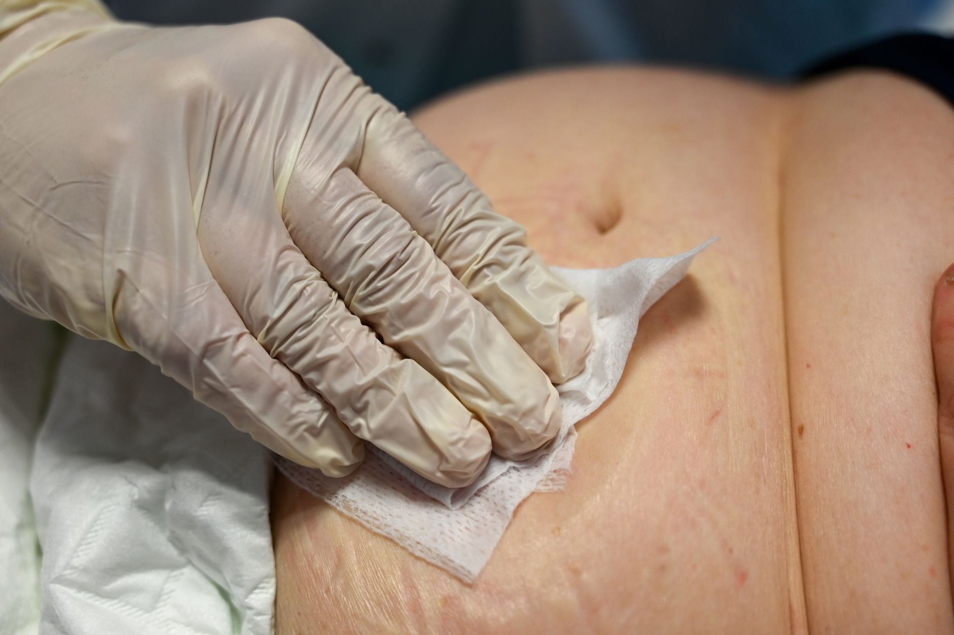 Close-up of a nurse cleaning a patient's wound in a clinical setting.